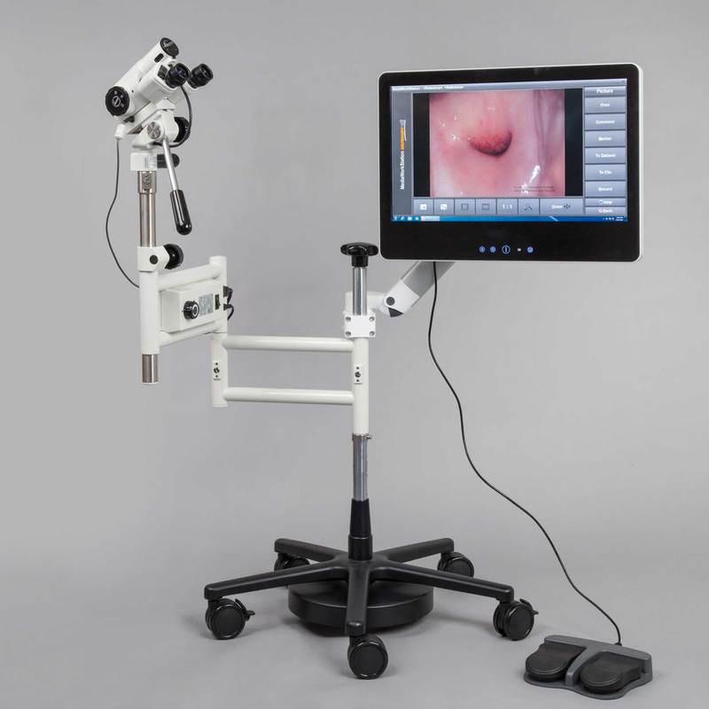 Colposcopy procedure