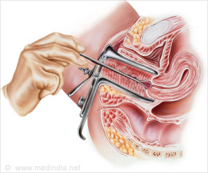 Endometrial biopsy procedure