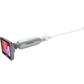 Hysteroscopy procedure