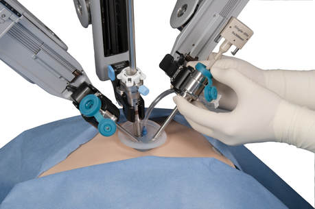 Robotic surgery port placement on patient abdomen